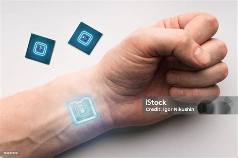 rfid skin chip|first rfid implant.